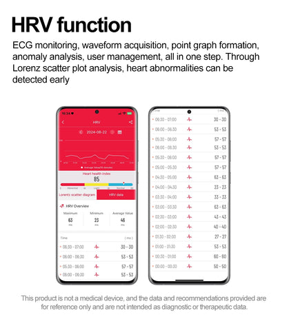 Montre Intelligente Xiaomi Femme - Diagnostic AI, HRV, PPG, IP68